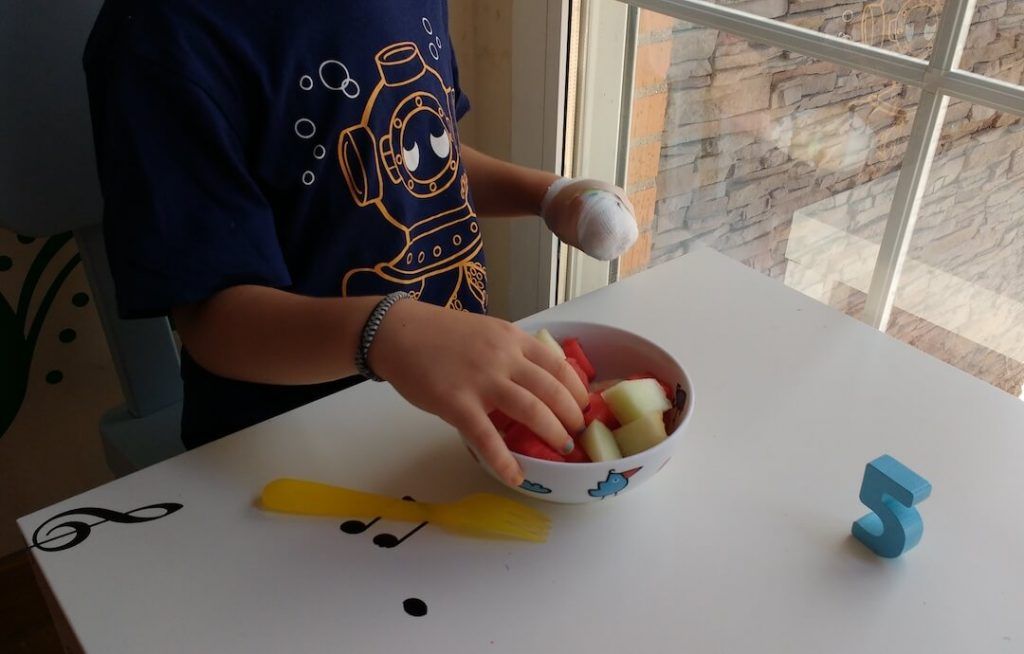 mi hijo comiendo trozos de fruta con la mano afectada por la hemiparesia, mientras lleva la otra vendada en puño